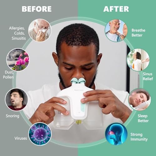 Electric Nasal Irrigation System with 50 Salt Packets, 2 Modes Nose Cleaner with SelfCleaning & Auto Waste Collection Function for Sinus Relief Runny Nose, Nasal Congestion, Itching Nose