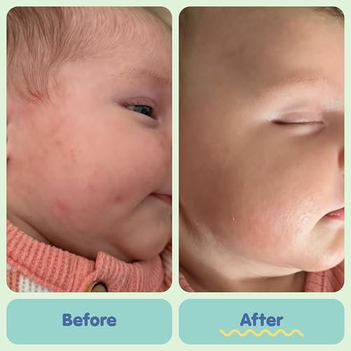 TUBBY TODD All Over Ointment - Baby Eczema Cream - Everyday Multi-Purpose Baby Skin Relief Cream - Sensitive Skin, Dry Skin, Rash, & Irritation - Steroid & Gluten Free - Fragrance-Free, 2 Pack, 8oz